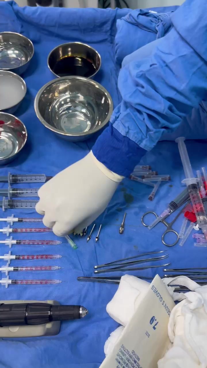 Hair Transplant Preparation